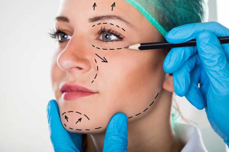Cirurgia Plástica de Nariz Chácara Paraíso - Cirurgia Plástica no Rosto