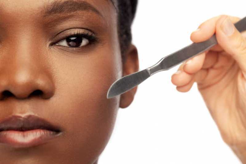 Cirurgia Plástica Facial Clínica Amparo - Cirurgia Plástica no Rosto