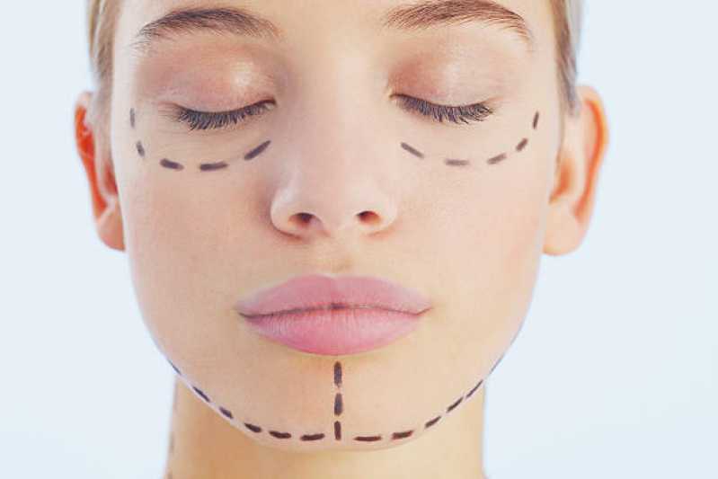Cirurgia Plástica Vila Sônia II - Cirurgia Plástica Facial