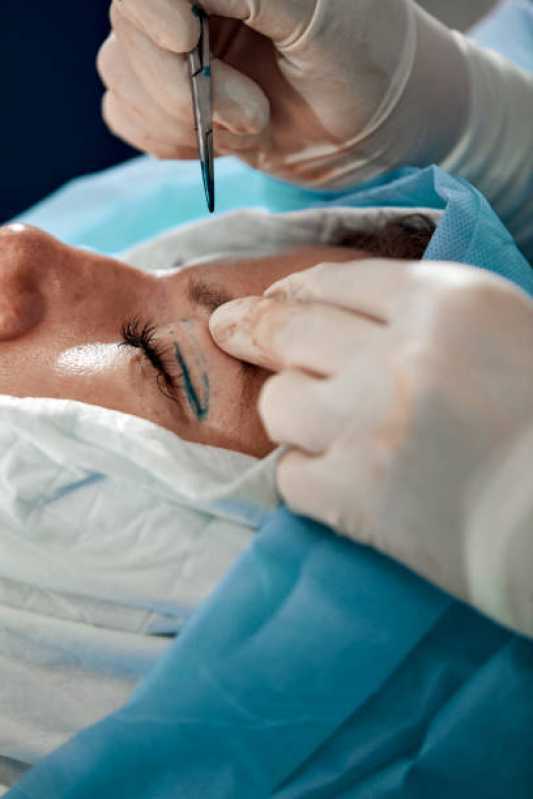 Cirurgia Reparadora Riqueza - Cirurgia Plástica no Rosto