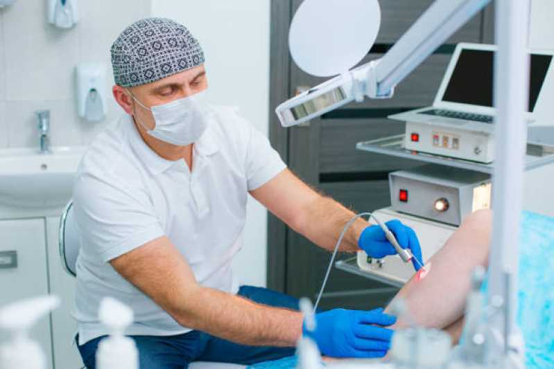 Cirurgia Varizes a Laser São Pedro - Cirurgia Vascular Membros Inferiores
