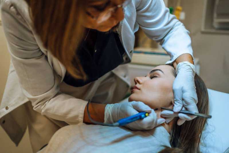 Consulta de Dermatologia Preenchimento Labial Marcar Nova Campinas - Consulta de Dermatologia para Acne