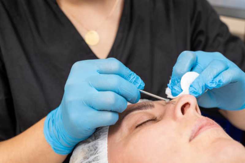 Consulta Dermatológica para Botox Jardim Amazonas - Consulta de Dermatologia Harmonização Facial