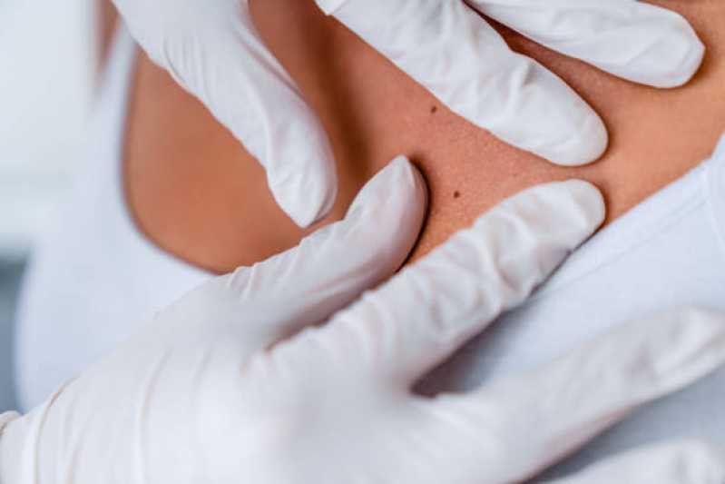 Dermatologia Integrada Cordeirópolis - Dermatologia Estética