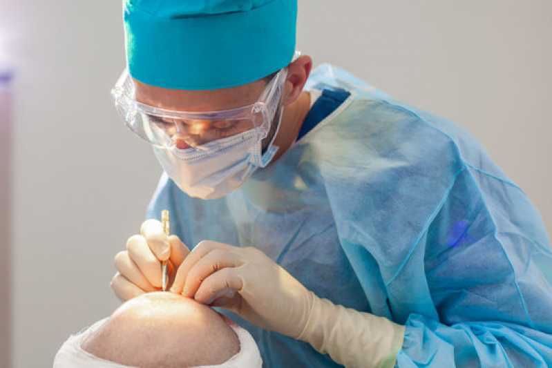 Endereço de Clínica de Implante de Cabelo Loteamento Claude de Barros Penteado- - Clínica para Tratamento de Cabelo
