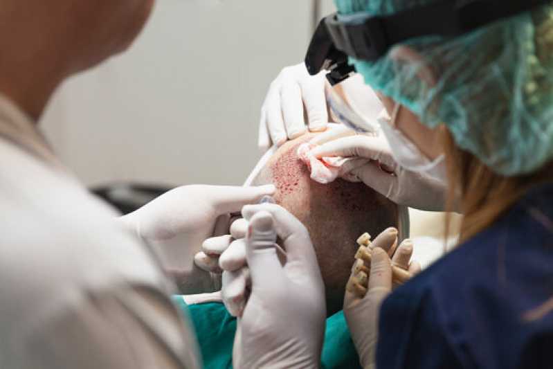 Endereço de Clínica para Tratamento de Cabelo Genebra - Clínica de Implante de Cabelo