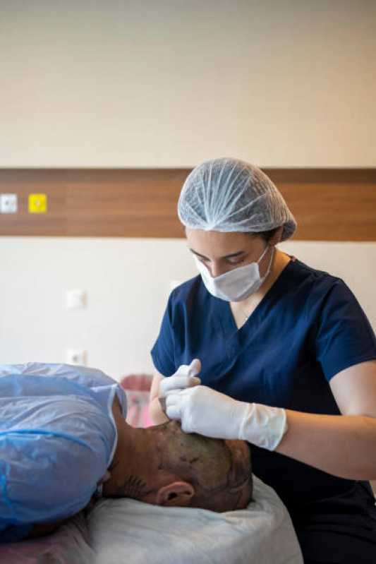 Implante Cabelo Masculino Parque das Universidades - Implante de Cabelo Fio a Fio
