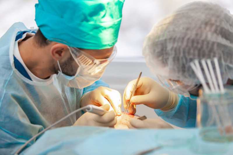 Implante de Cabelo Fia a Fio Clínica Parque Industrial - Implante Cabelo Masculino