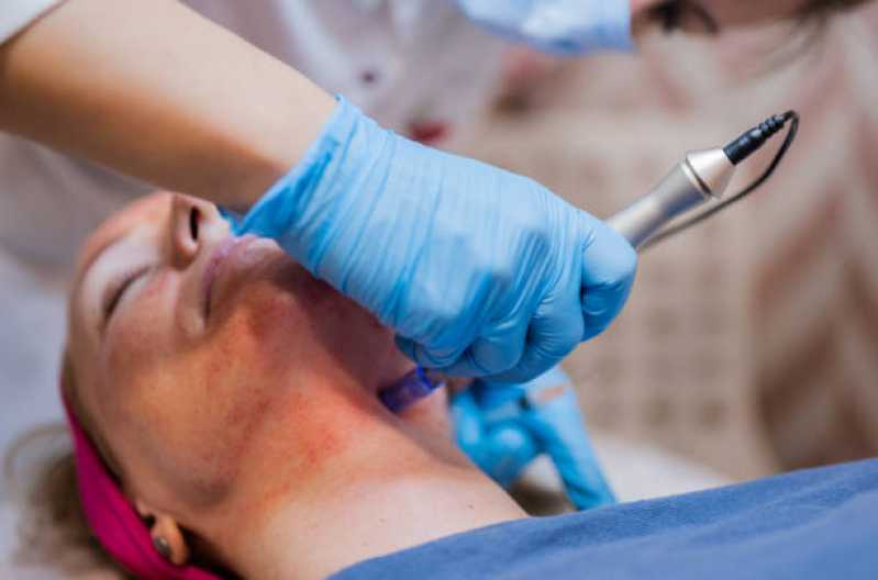Onde Agendar Dermatologia Oncológica Notre Dame - Dermatologia para Os Cabelos