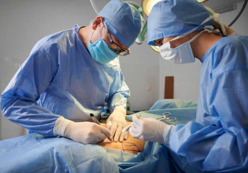 Onde Fazer Cirurgia Reparadora de Mama Cordeirópolis - Cirurgia Plástica no Braço