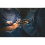 cirurgia vascular a laser agendar Socorro