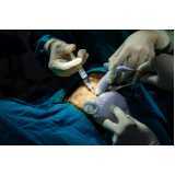 clínica para implante capilar Parque das Hortênsias