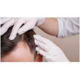 tricologia do cabelo clínica Sitio dos Cambáras