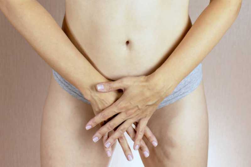 Tratamento de Estética íntima Mulher Agendar Parque da Hípica - Tratamento de Estética íntima