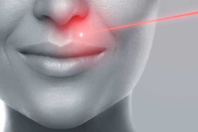 Tratamento Laser Fotona Marcar Jardim Von Zuben - Tratamento de Laser Fotona no Rosto